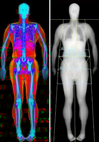 Dexascan body image