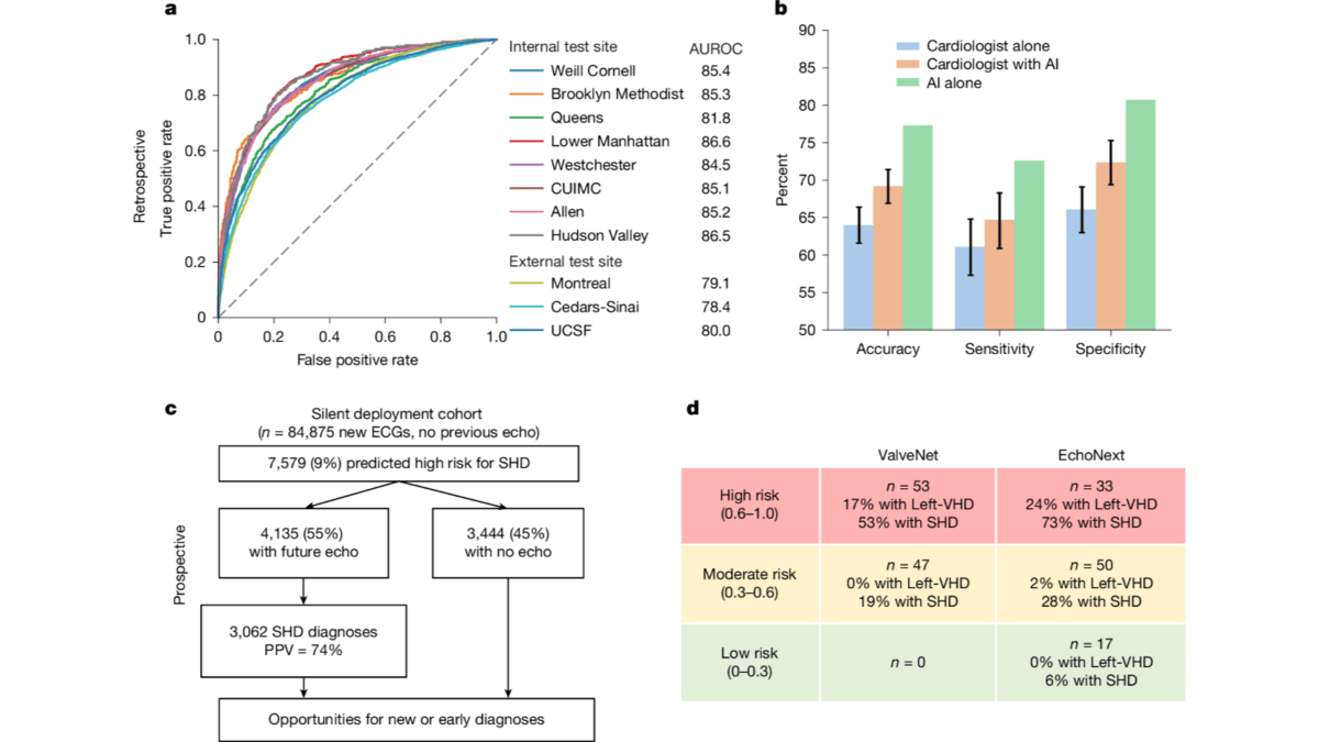 AI Model Detects Hidden Heart Disease