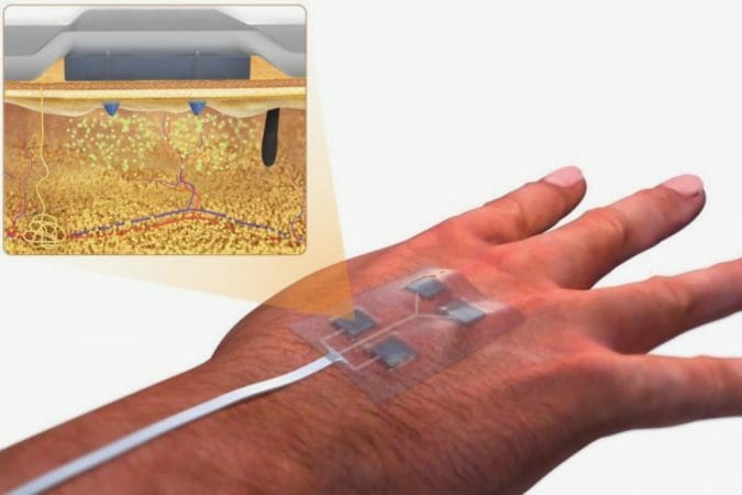 Remote-controlled dressing allows medication to be administered without having to remove it