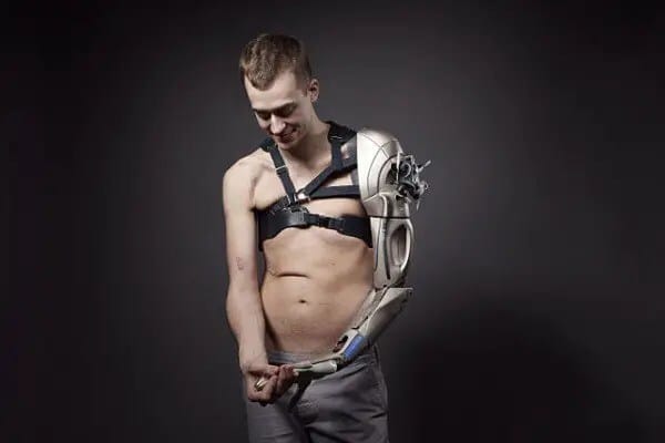 cyborg-arm-600x400