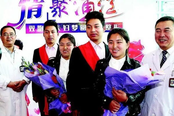 identical-twins2-600x401