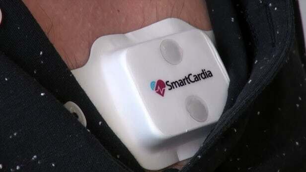 Smartcardia - Invent a connected object to unclog hospitals