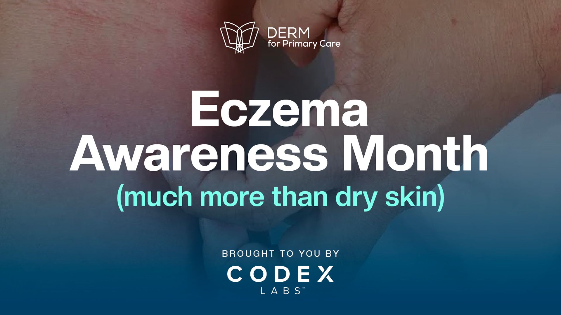 Let’s Talk Eczema: Science, Support & Stories That Matter