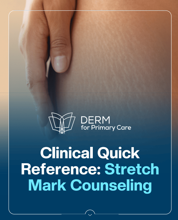 April_29_-_Clinical_Quick_Reference_Stretch_Mark_Counseling.pdf