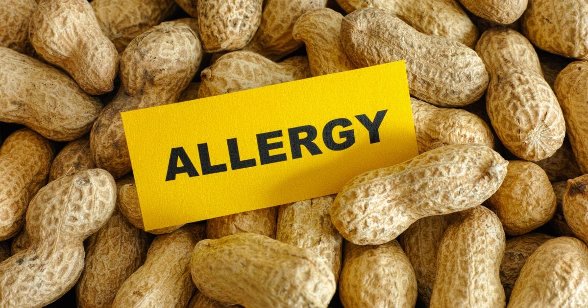 Gut Bacteria May Influence Peanut Allergy Severity