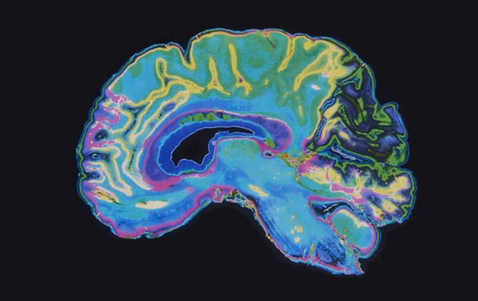 🧠 The Evidence Behind Psilocybin's Ability to Rewire The Brain & Overcome Trauma...