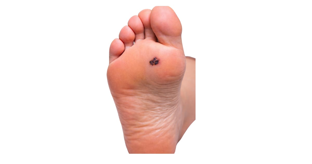 🩺 Examinas la planta de los pies?