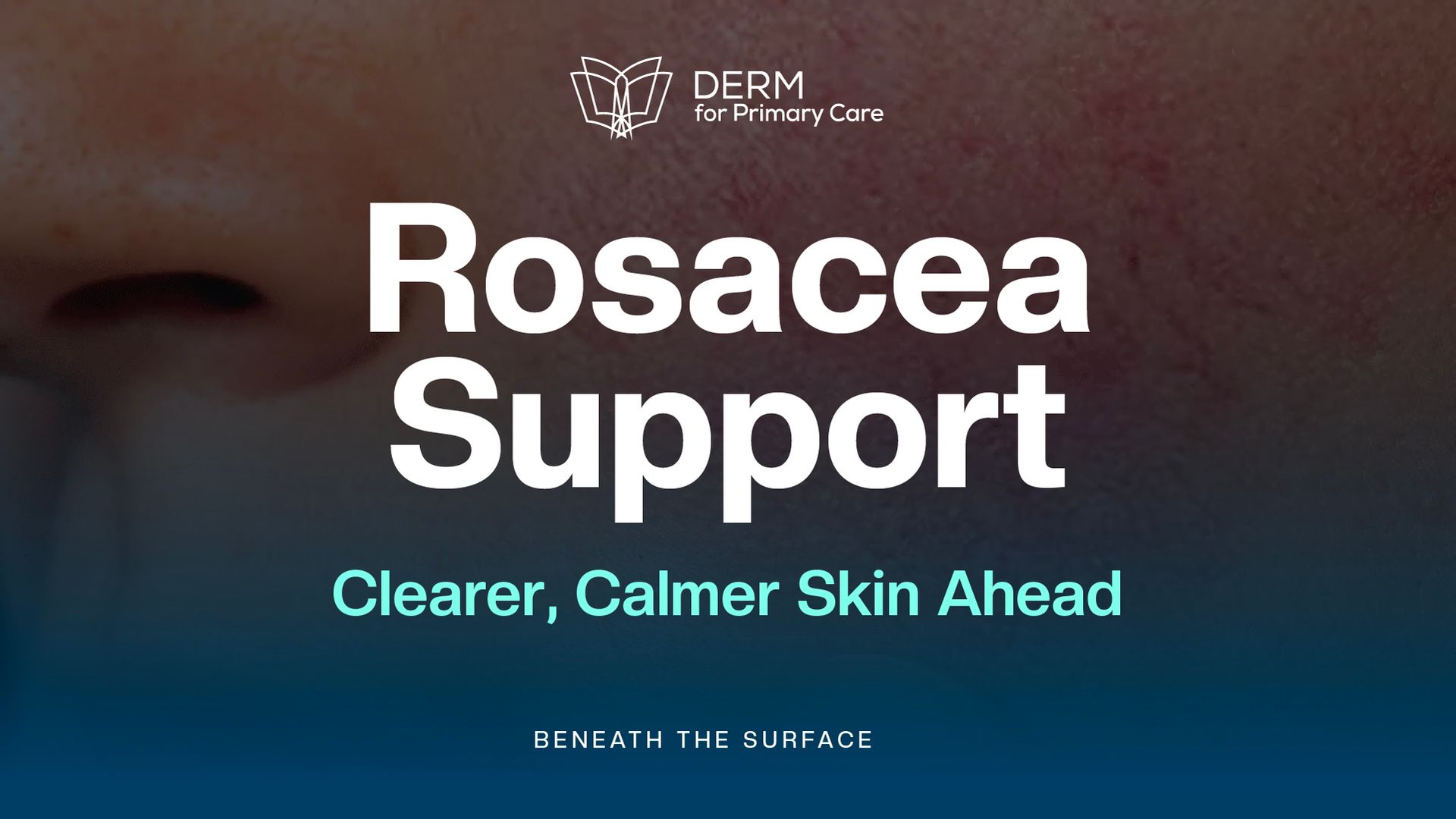 Rosacea or Something Else? Key Clinical Signs for Accurate Diagnosis
