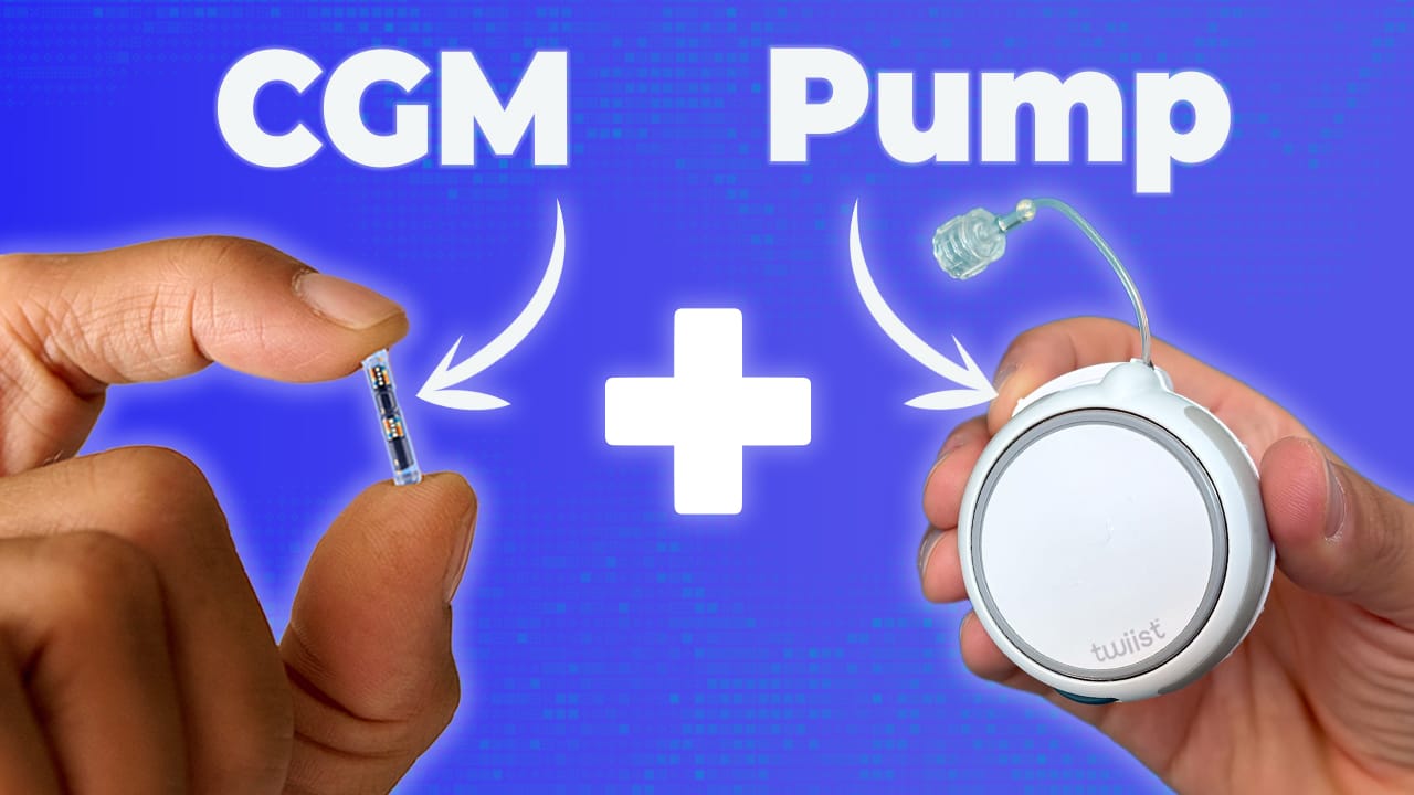 Inside the Eversense 365 + Twiist AID Integration