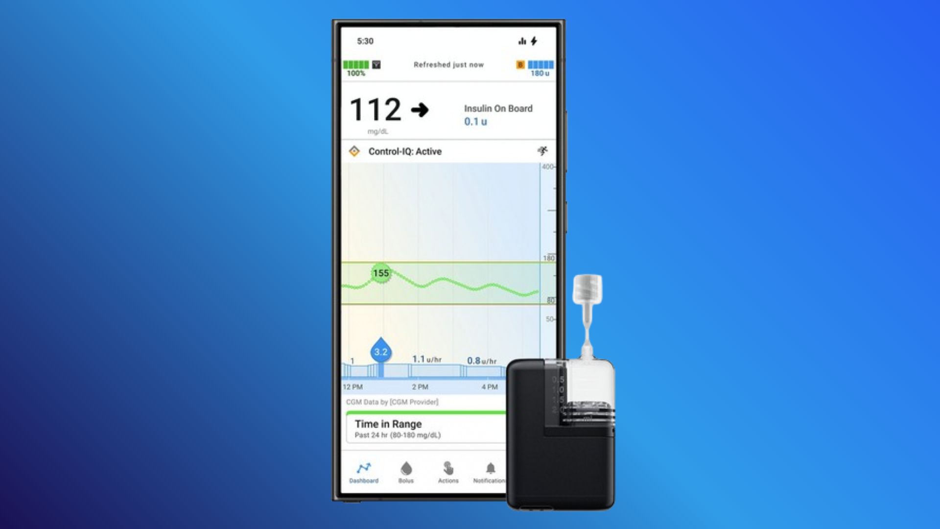 Tandem Mobi Insulin Pump Now Supported on Android