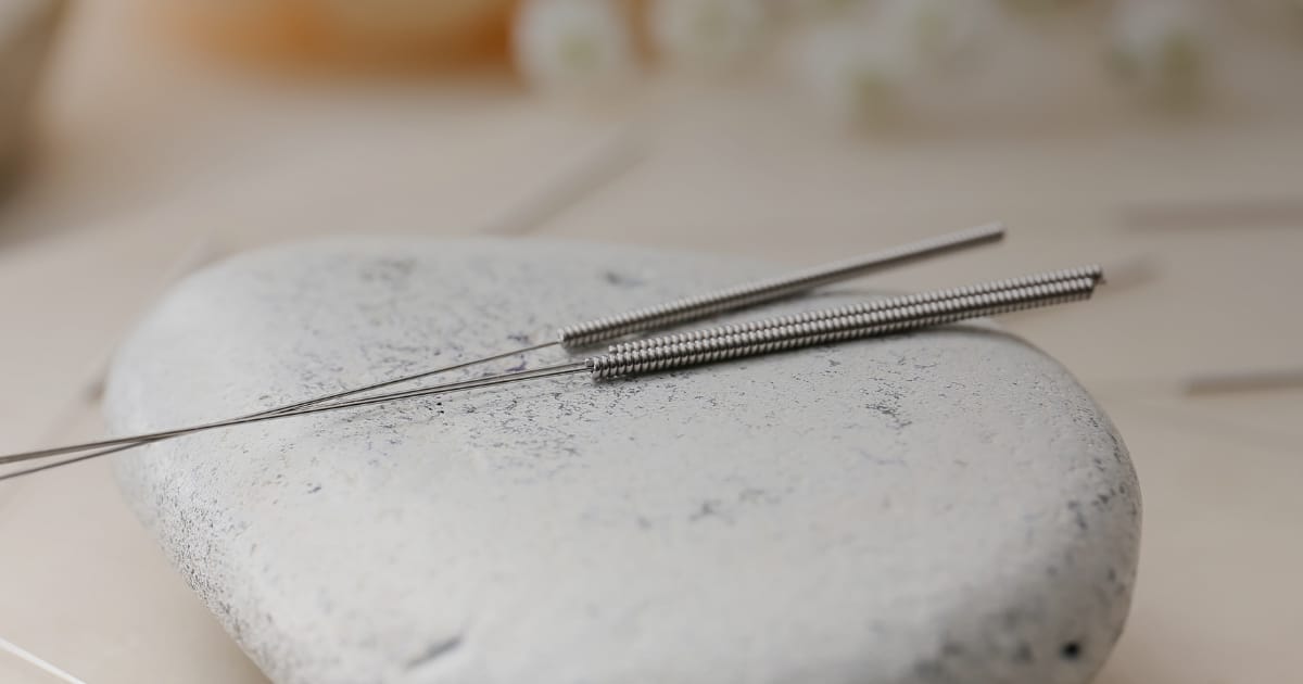 Effect of acupuncture for diminished ovarian reserve