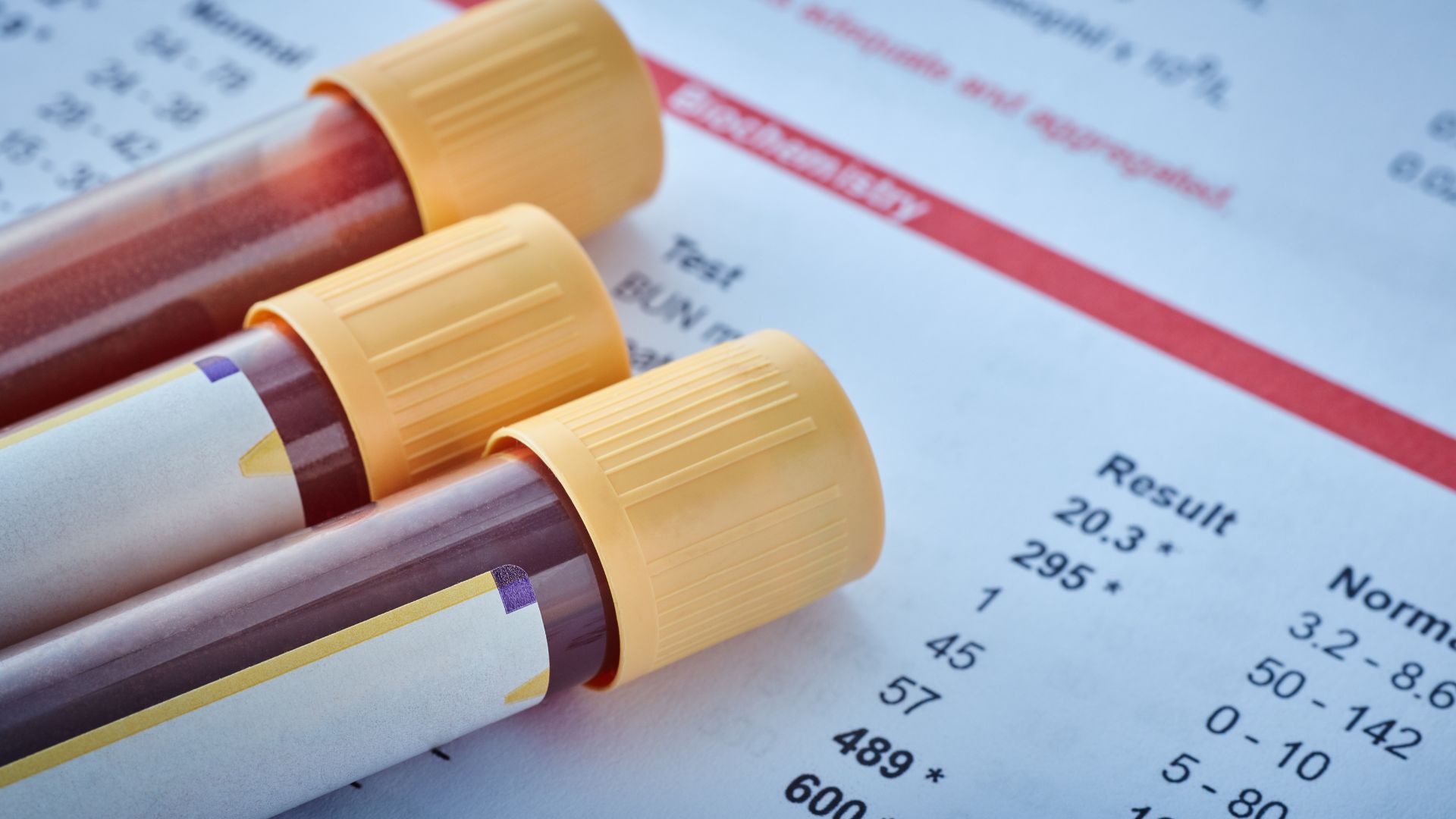 Adventuring through the Canadian Rockies