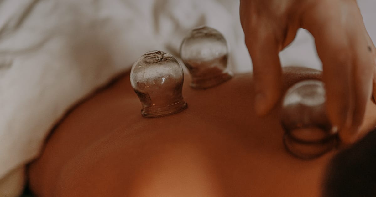 Sliding cupping vs. Light therapy: A new study on plaque psoriasis