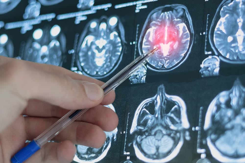 The Brains That Didn't Break 