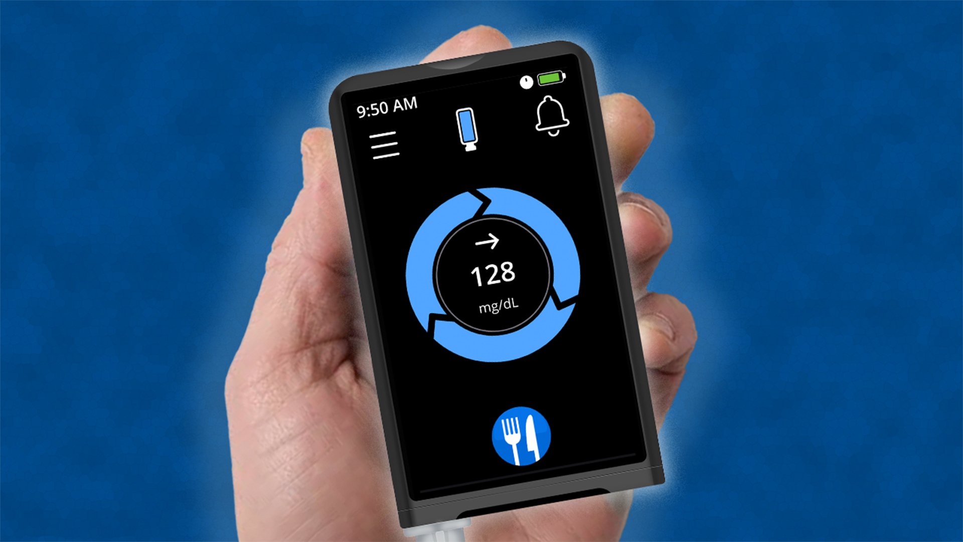 Beta Bionics iLet Insulin Pump Doesn't Require Carb Counting