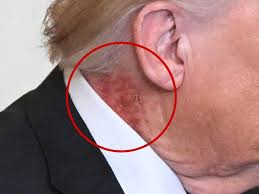 Trump Has Herpes, Kegesth Is Drunk Again, We Are Still Bombing Iran And Might Put Soldiers On The Ground