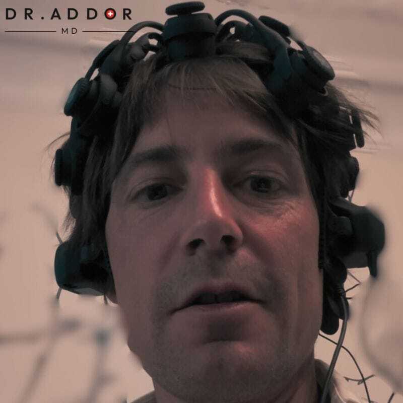 Le système glymphatique : votre allié secret contre le déclin cognitif et la démence