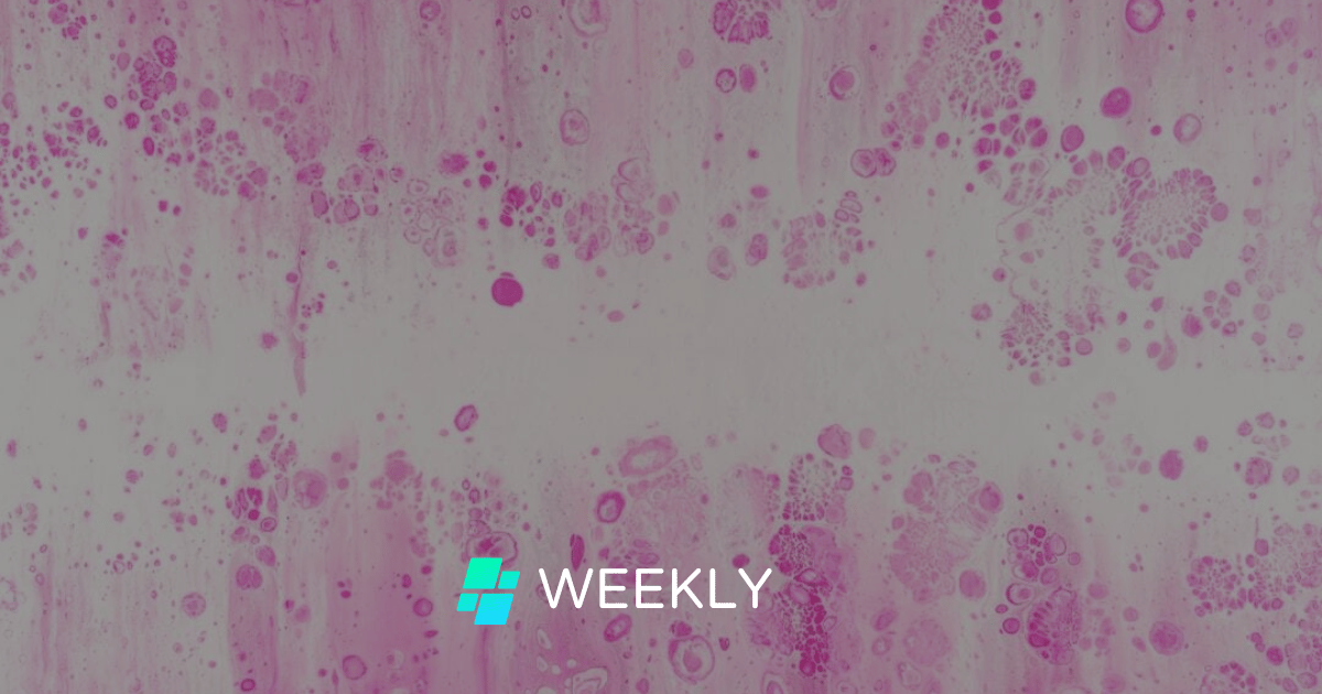 🔬 KI entdeckt 27 Prozent mehr Brustkrebserkrankungen