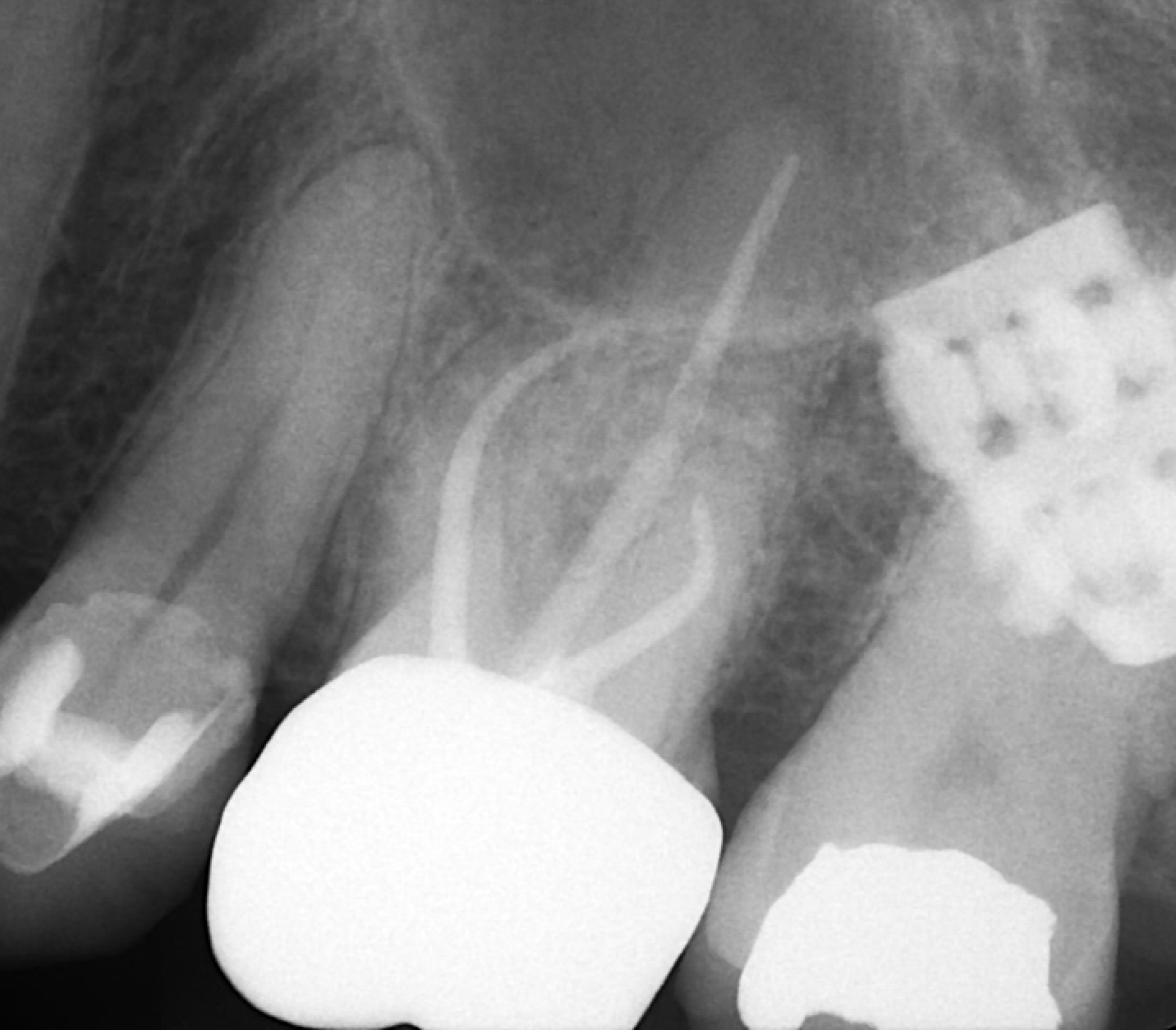 To do the RCT or not to do the RCT?