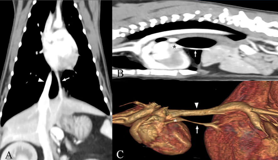 More anomaly that can be seen with portosystemic shunt