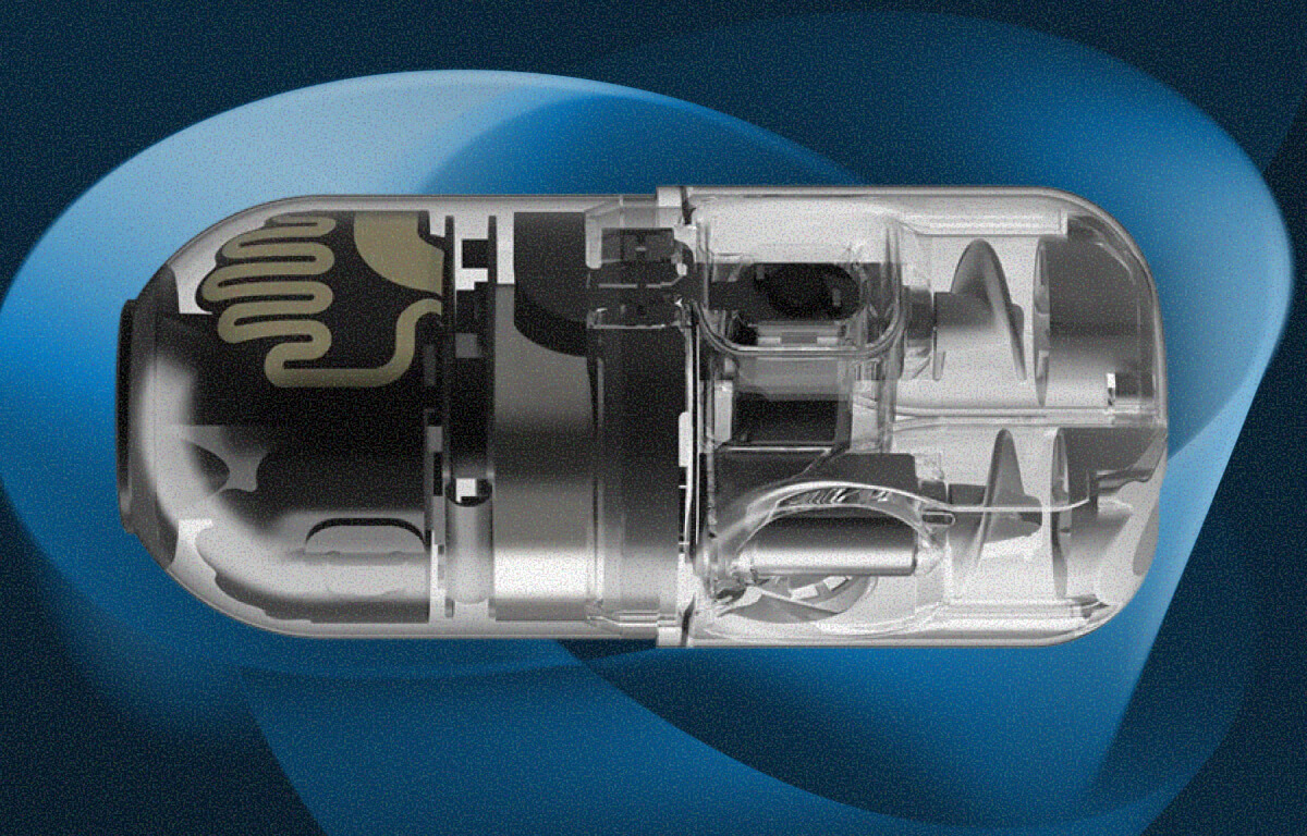 Surgical Microrobots Bring AI Into the Body