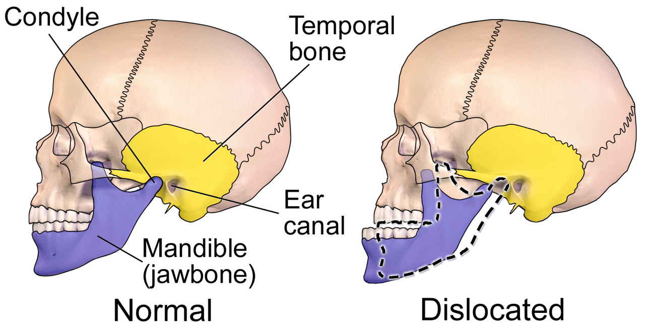Why it matters that we recognize TMJ Awareness Month