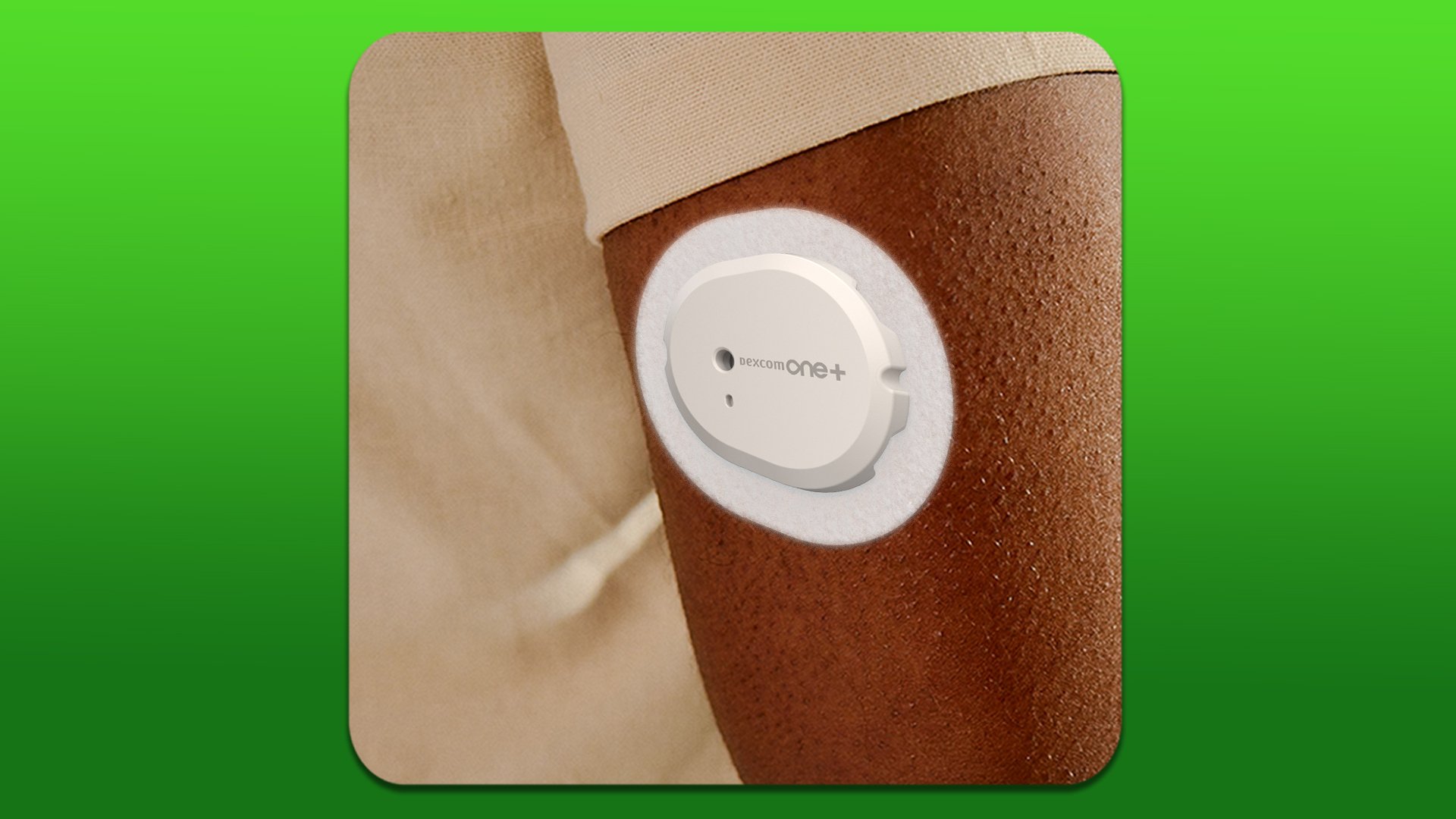 Dexcom ONE+ CGM — What You Need to Know