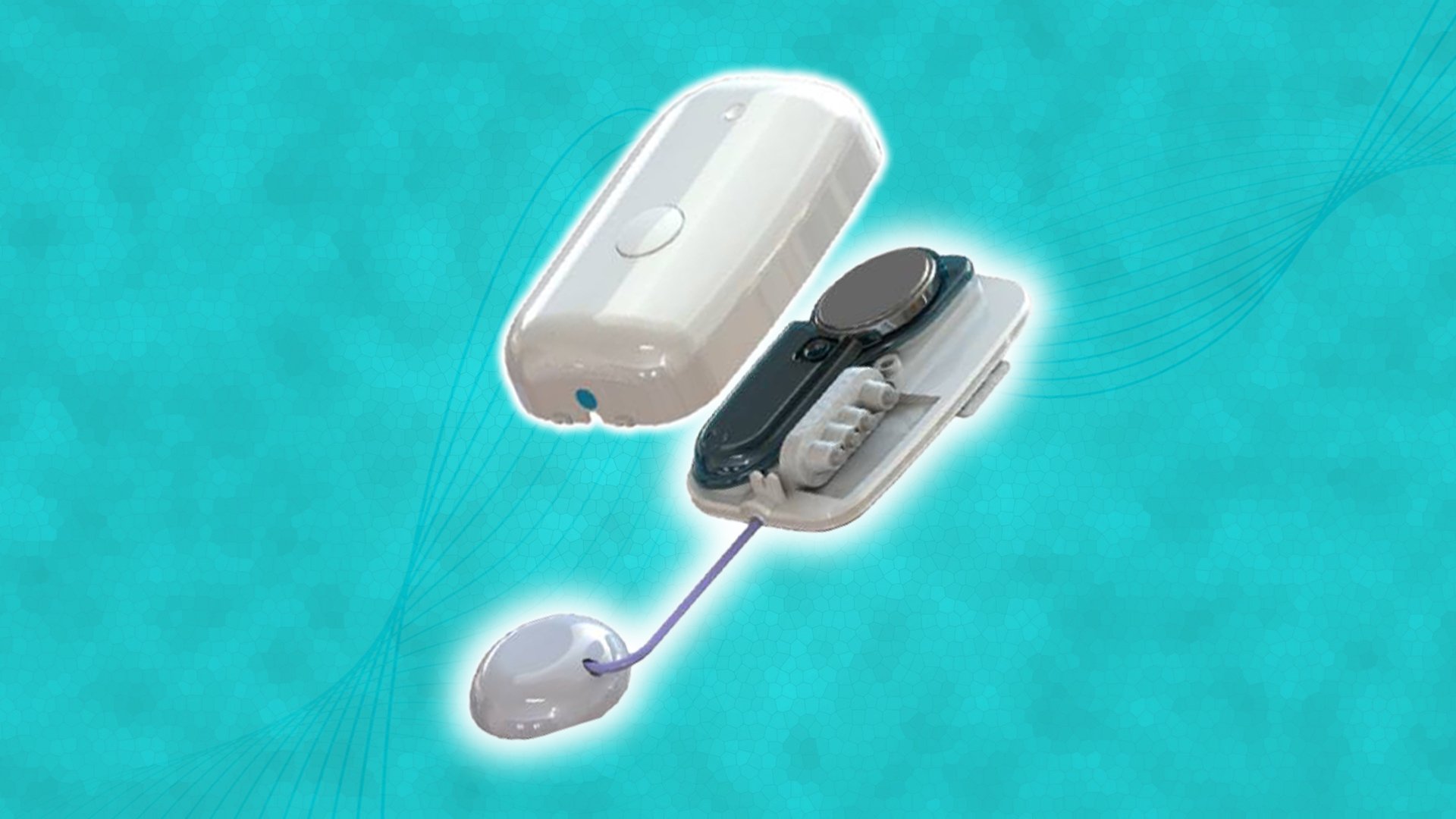 MODD-1: The Modular Insulin Pump   Explained