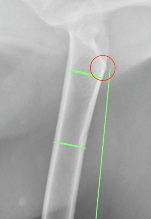 Femoral Cortical Thickness Index in a Population of Dogs Undergoing Total Hip Replacement