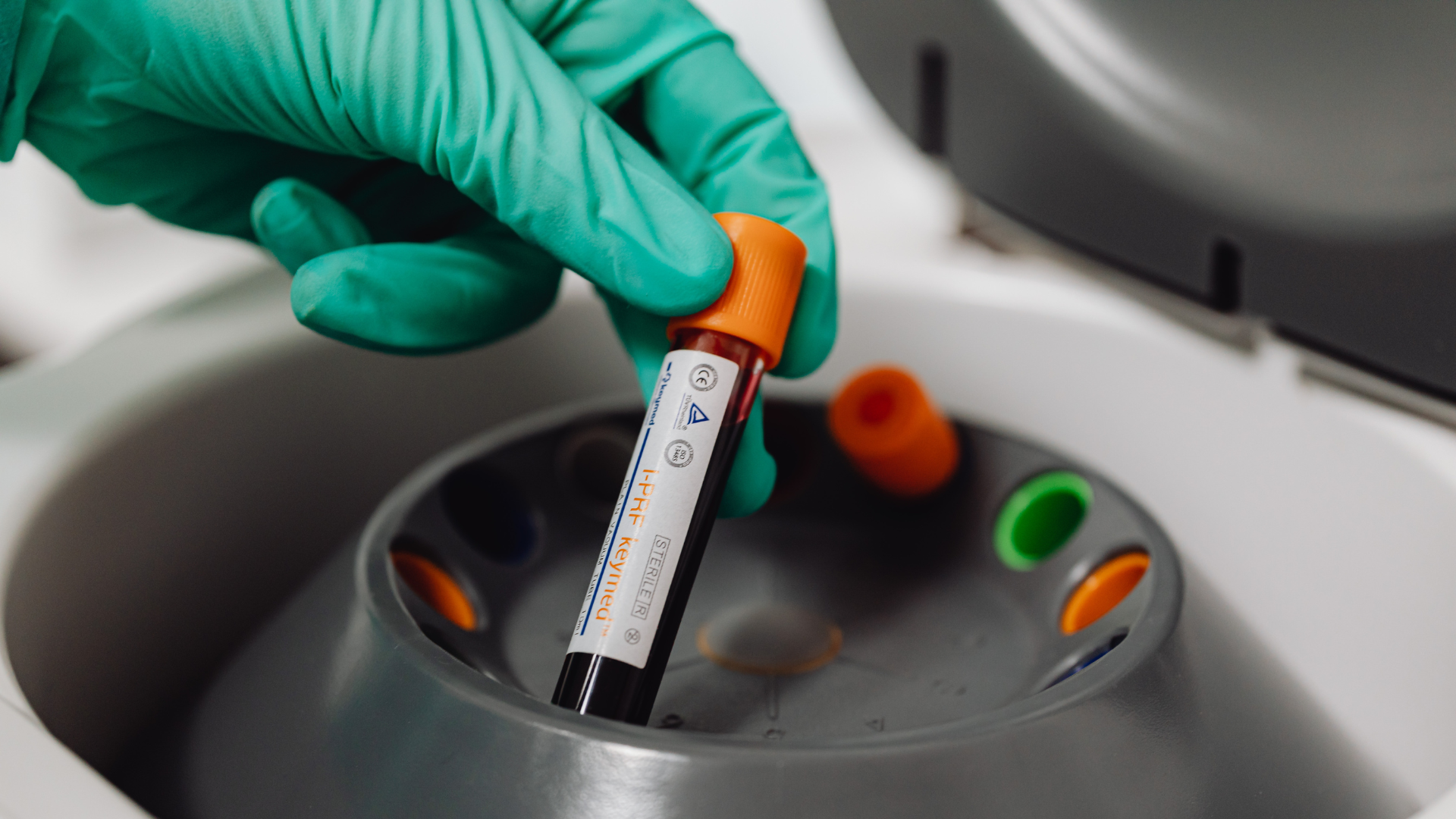 Testosteron: genug für die Statistik, zu wenig fürs Leben