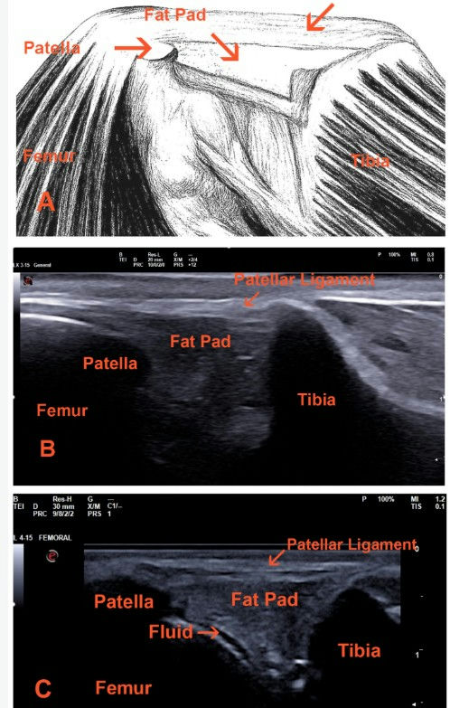 New Review: How Ultrasound Transforms Canine Stifle Diagnostics
