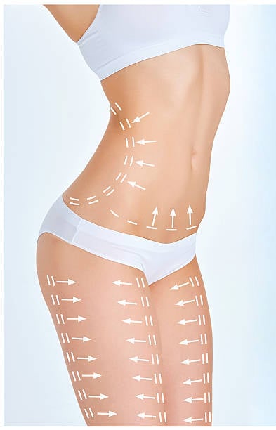 Body Sculpting Procedure and Its Role in Body Shaping Goals