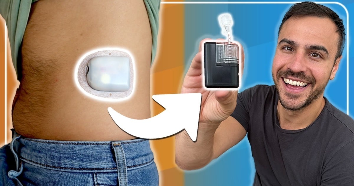 From Omnipod to Mobi – What the Move from Tubeless to Tubed Was Like