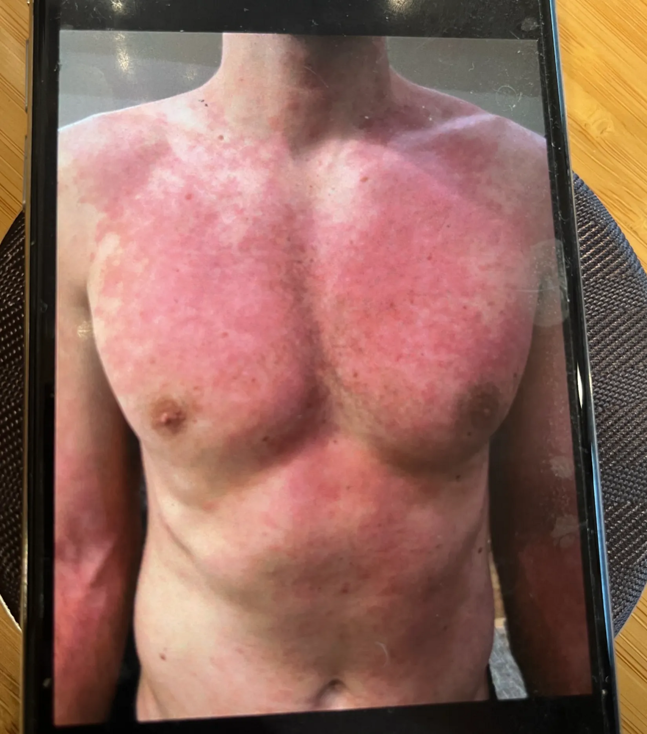 How Discovering I Had Parasites Ended My 11-Year Health Nightmare