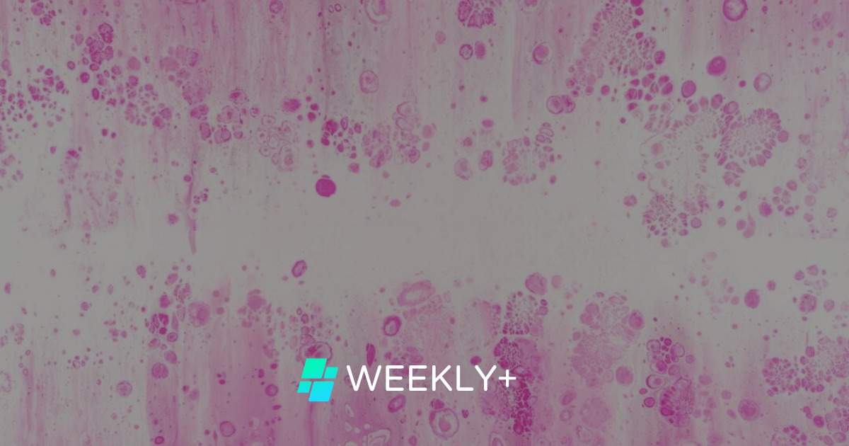 🔬 KI entdeckt 27 Prozent mehr Brustkrebserkrankungen