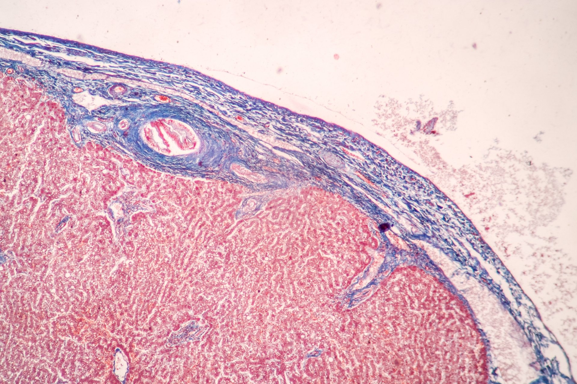 🩺 What 47,000 spleens just taught us 