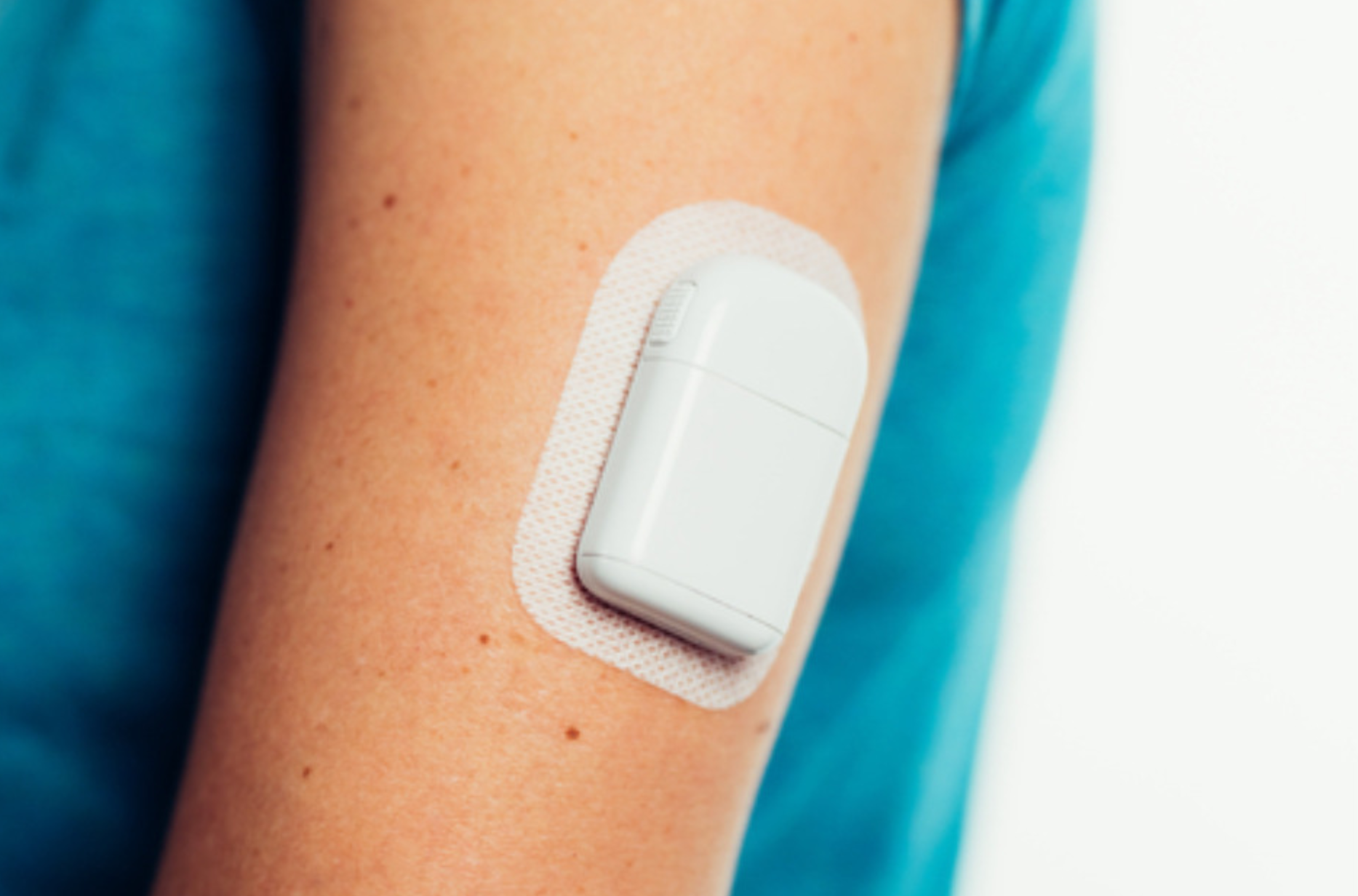 Sigi: Tandem Diabetes' Tubeless Insulin Pump In Development