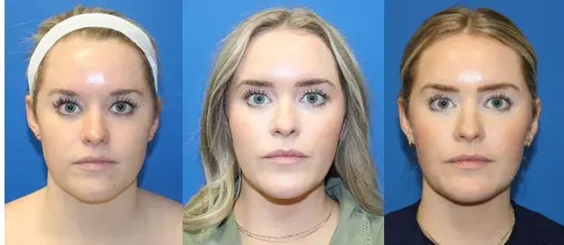 Group Chat Girlies: 6 Years of Face Receipts