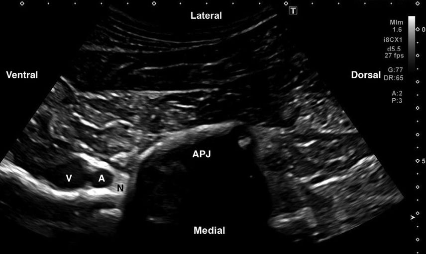 New Equine Injection Technique Boosts Accuracy—Without Epidural Risk