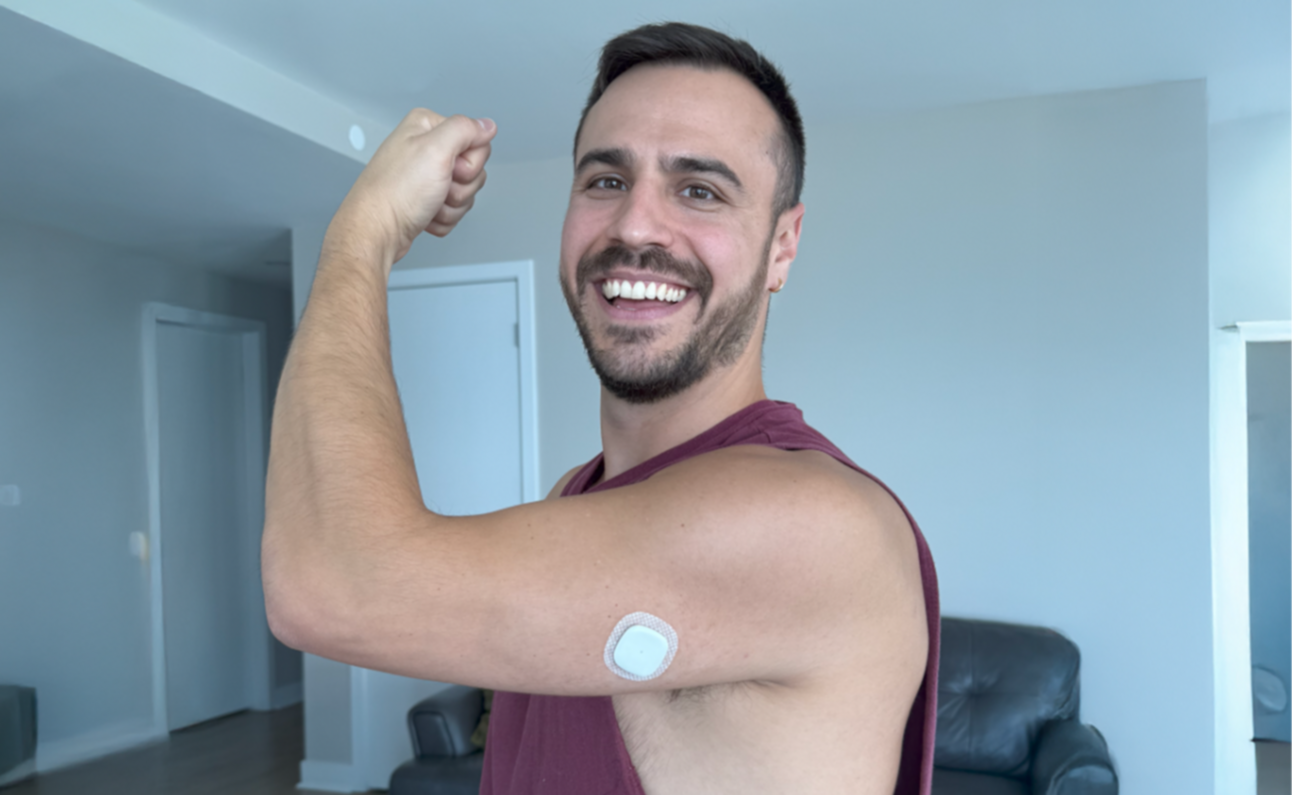 I Wore Medtronic's Simplera CGM - Here's How it Went