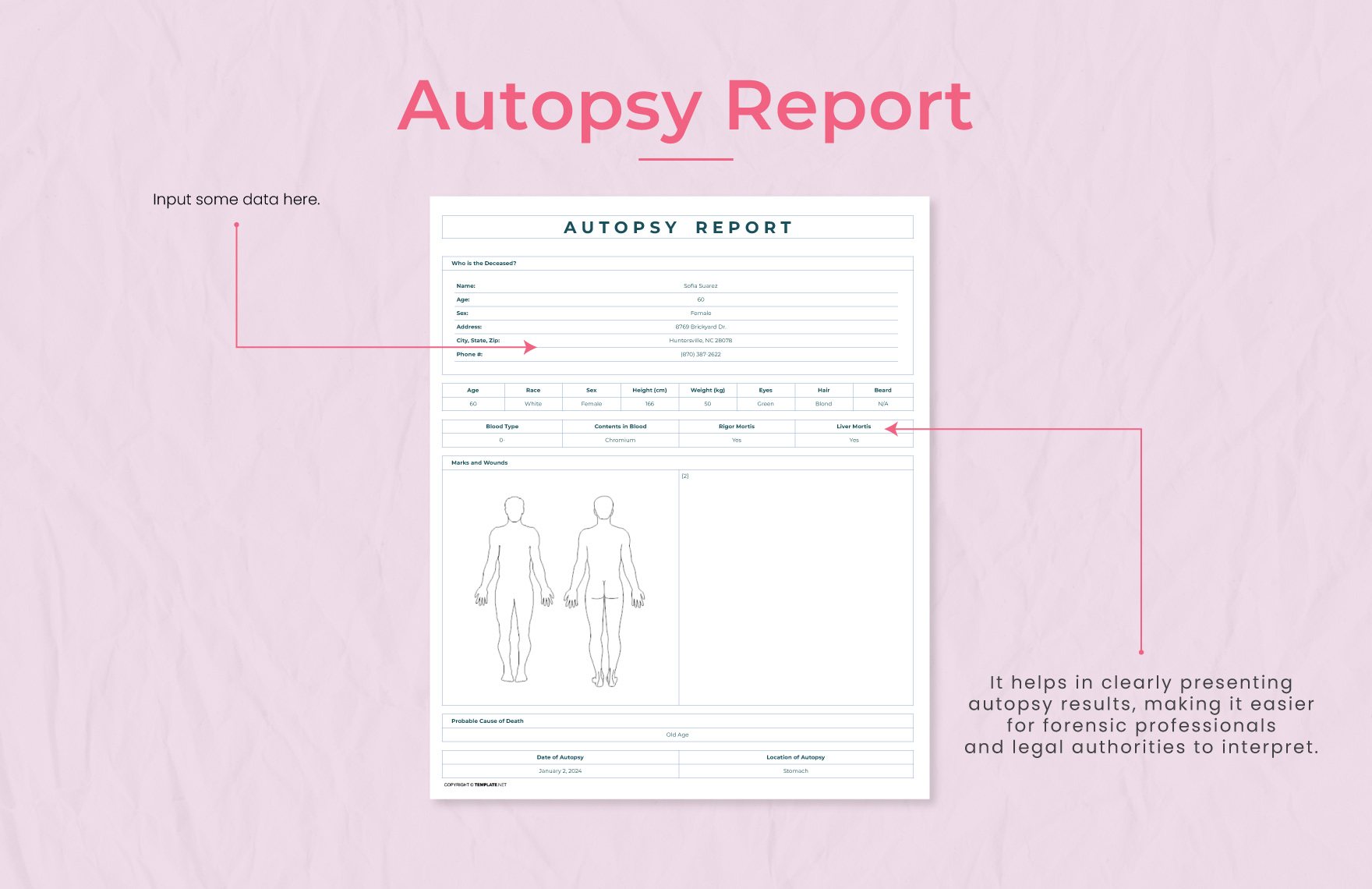The "Missing" DNC Autopsy