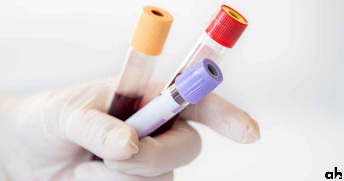 Coggins Testing For Horses - What You Need To Know