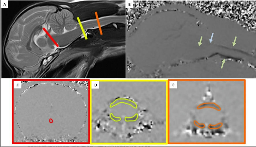 MRI Reveals Slowed Cerebrospinal Fluid Flow in Small Dogs With Enlarged Ventricles