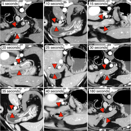 Defining the Ideal CT Pancreatic Phase in Dogs: Evidence-Based Scan Timing for Peak Enhancement
