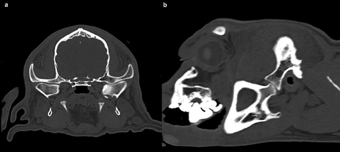 Innovative CT-Guided Coronoidectomy Resolves TMJ Dysplasia in Young Basset Hound