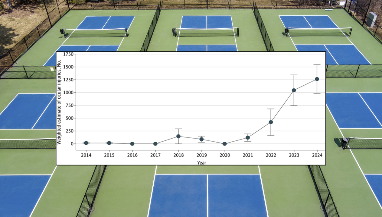 Pickleball eye injuries are on the rise