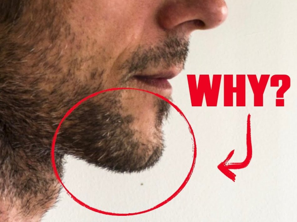 Why Do Humans Have Chins? We’re the Only Species That Does.