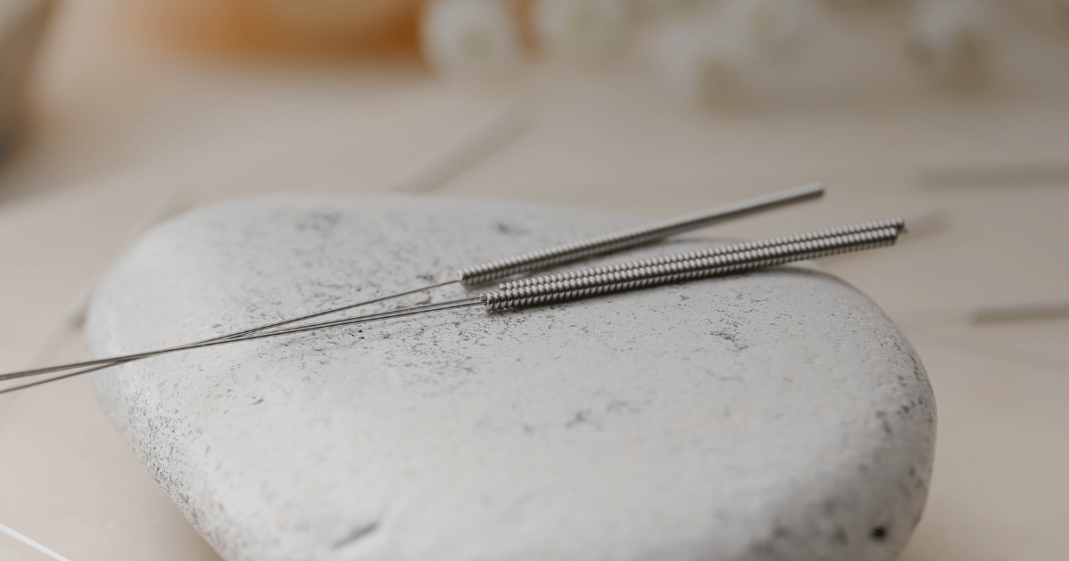 Effect of acupuncture for diminished ovarian reserve