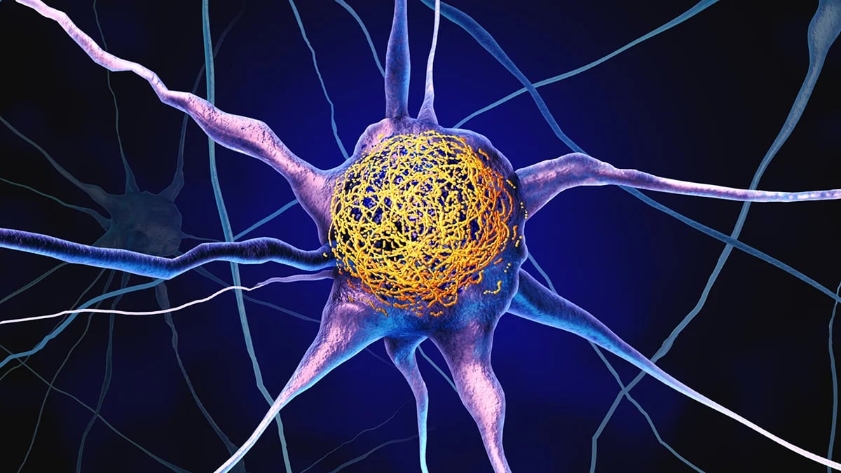 A Vitamin Linked to Alzheimer's Tangles