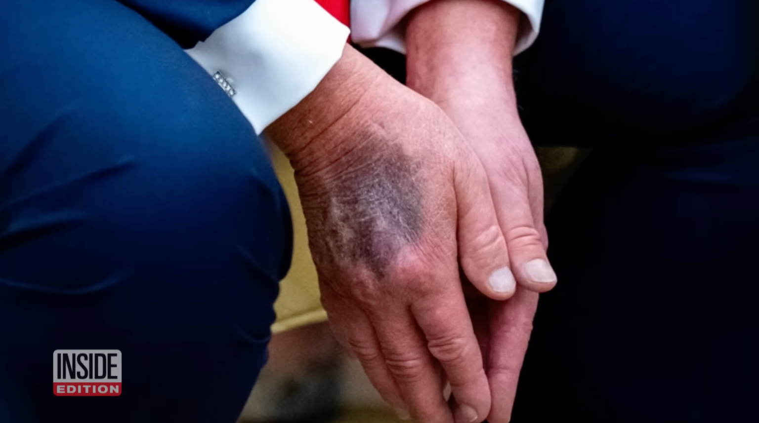 The Trump Story The Media Won't Cover